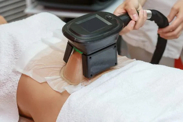 Image of person having fat freezing treatment to help weight gain Cardiff