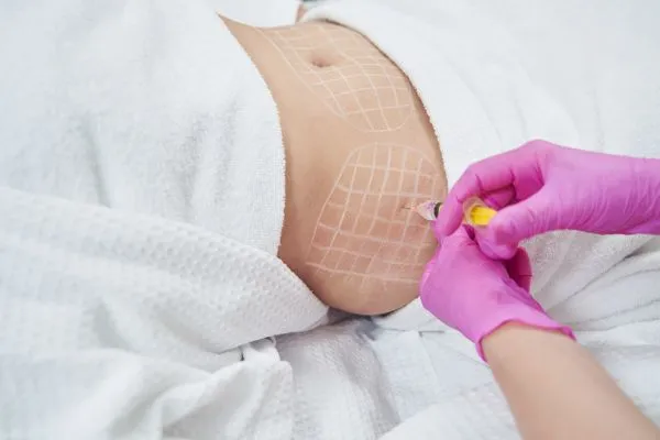 image of fat dissolving injections on love handles to help combat weight gain Cardiff