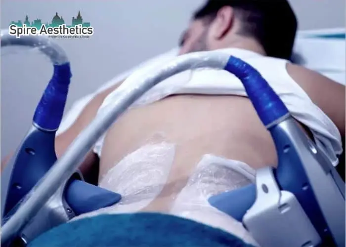 Man having fat freezing treatment done on love handles before a competitions Cardiff to create a sculpted look.