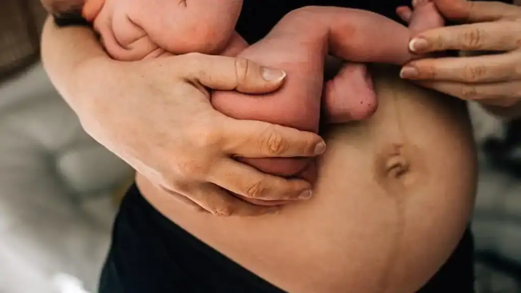 Why Is My Stomach Still Big After Pregnancy Cardiff?